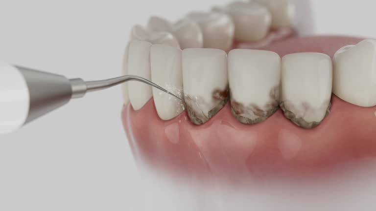 Trusted Wisdom Tooth Removal service in Green Level, NC - Dentist Open Now